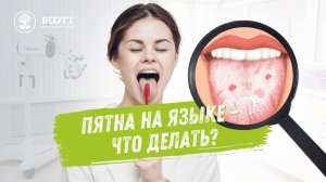 Пятна на языке, бактерии и гигиена. Откуда берутся и что делать? ROOTT.