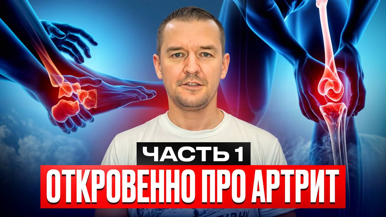 Откровенно про артрит. Часть 1 смотреть онлайн
