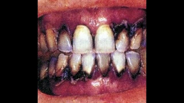 NECROTRAP TYPE BEAT - 