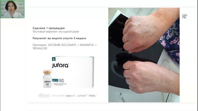 Руки — как ключевая зона в антивозрастном протоколе