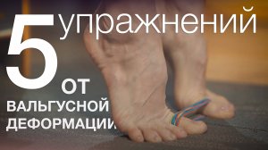 5 упражнений против вальгусной деформации