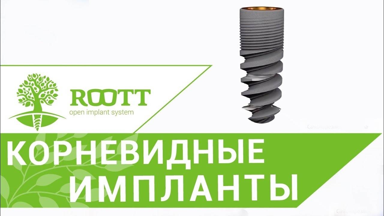 Зубные импланты виды. Особенности корневидных зубных имплантов. смотреть онлайн