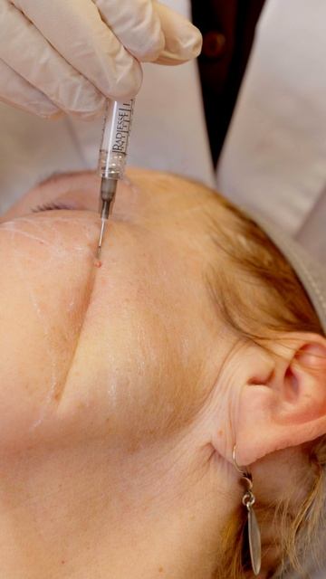 В клинику «Гельтек» обратилась пациентка 67 лет. смотреть онлайн