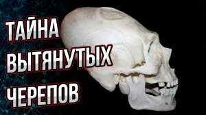 Вытянутые черепа не только в Южной Америке, но и на Северном Кавказе!  Андрей Буровский