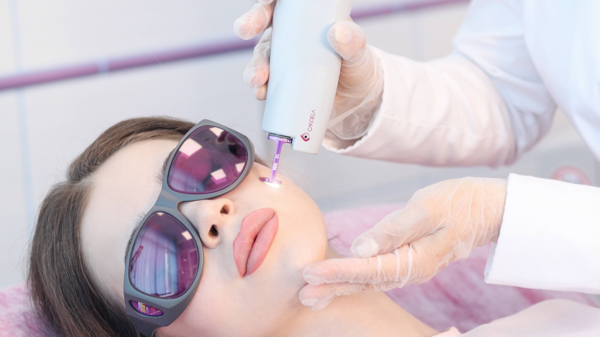 Лазерное омоложение на аппарате Candela Vbeam смотреть онлайн
