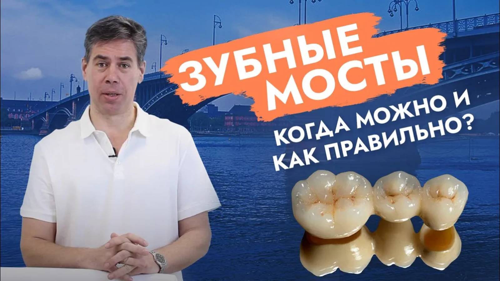Когда зубной мост простоит долго, а когда навредит?