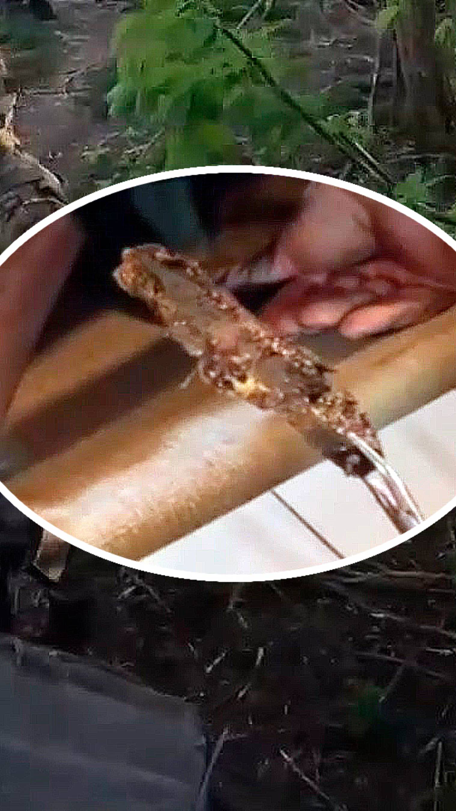 Осколок снаряда 20 см достали из десантника военные медики прямо на фронте! смотреть онлайн