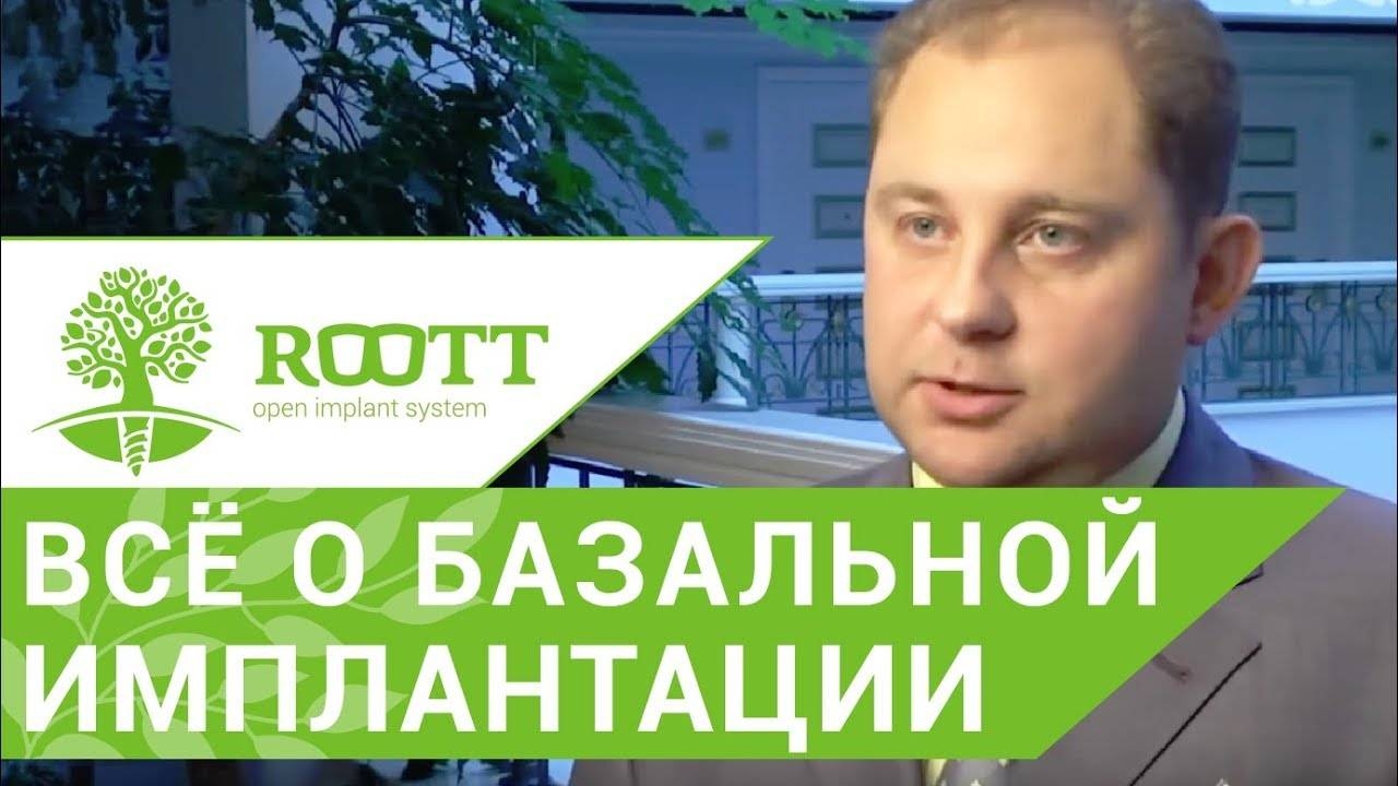 Базальная имплантация. Отзывы ведущих стоматологов о базальной имплантации. ROOTT смотреть онлайн