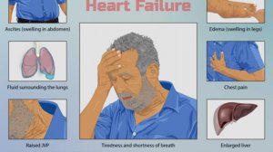 Хроническая Сердечная Недостаточность (ХСН) - Этиология, Патогенез, Клиника, Диагностика, Лечение