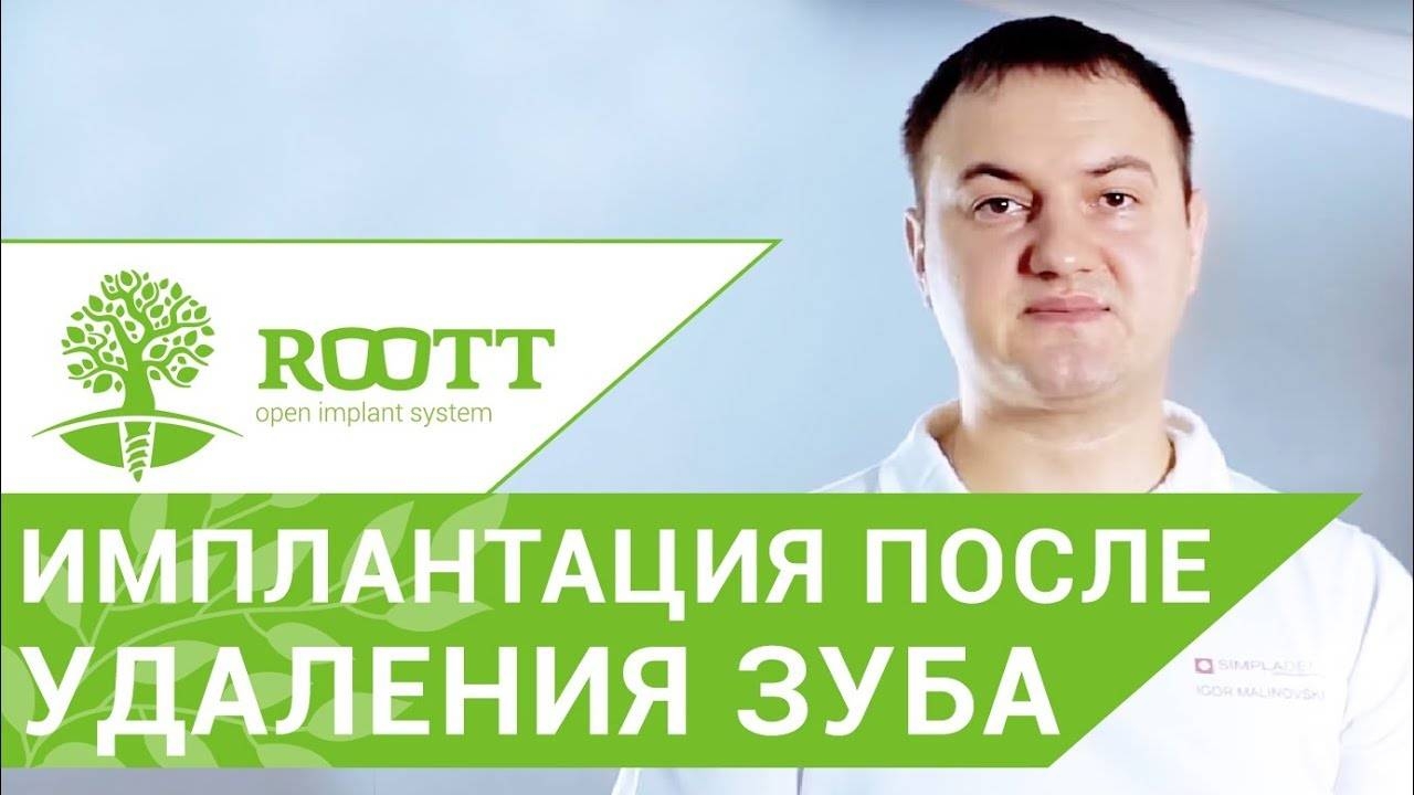 Установка импланта после удаления зуба. В чем преимущество установки импланта после удаления зуба смотреть онлайн
