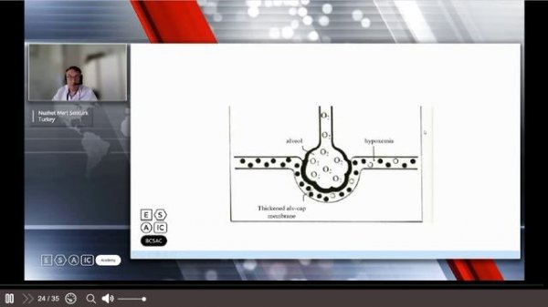Respiratory Anatomy _ Physiology