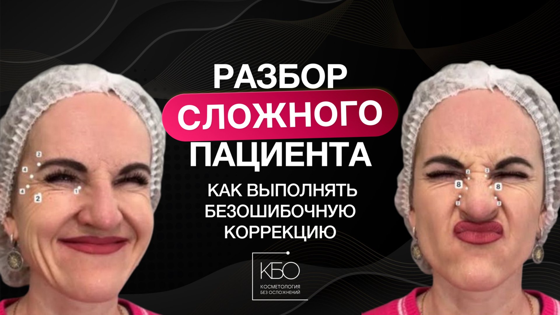 Ботулинотерапия. Разбор «Сложного» пациента: как выполнять безошибочную коррекцию смотреть онлайн