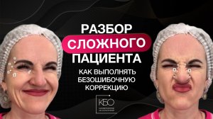 Ботулинотерапия. Разбор «Сложного» пациента: как выполнять безошибочную коррекцию