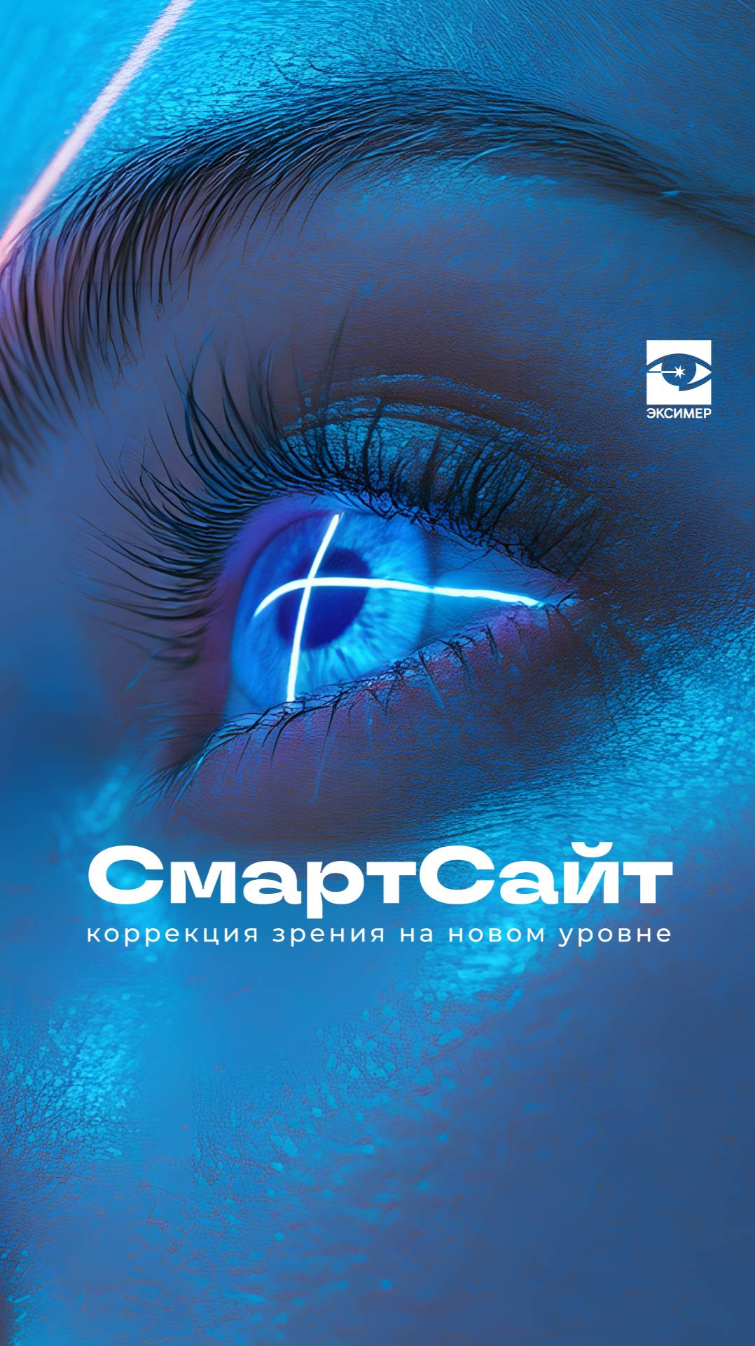 СмартСайт — инновационная технология лазерной коррекции смотреть онлайн