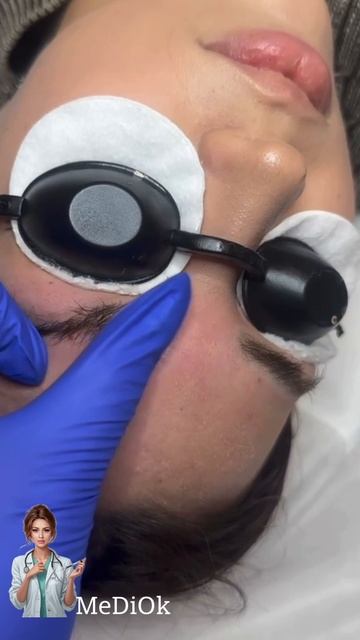 Удаление тату