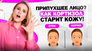 Ваш стресс написан на лице - как привести себя в норму и избавится от отеков?