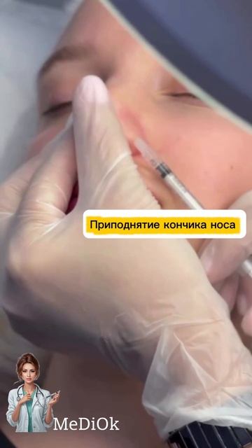 Ринопластика