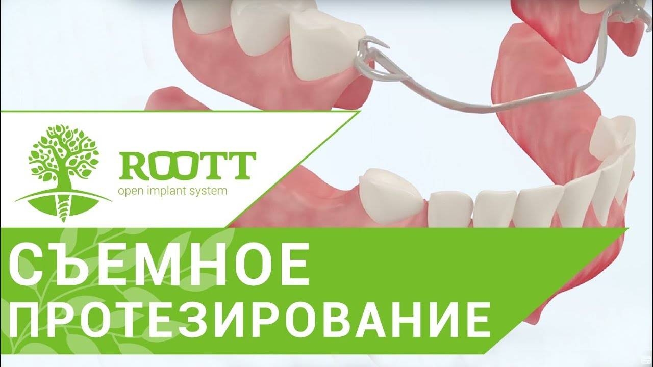 Виды съемных зубных протезов. Различные способы крепления и виды съемных зубных протезов. смотреть онлайн