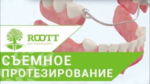 Виды съемных зубных протезов. Различные способы крепления и виды съемных зубных протезов.