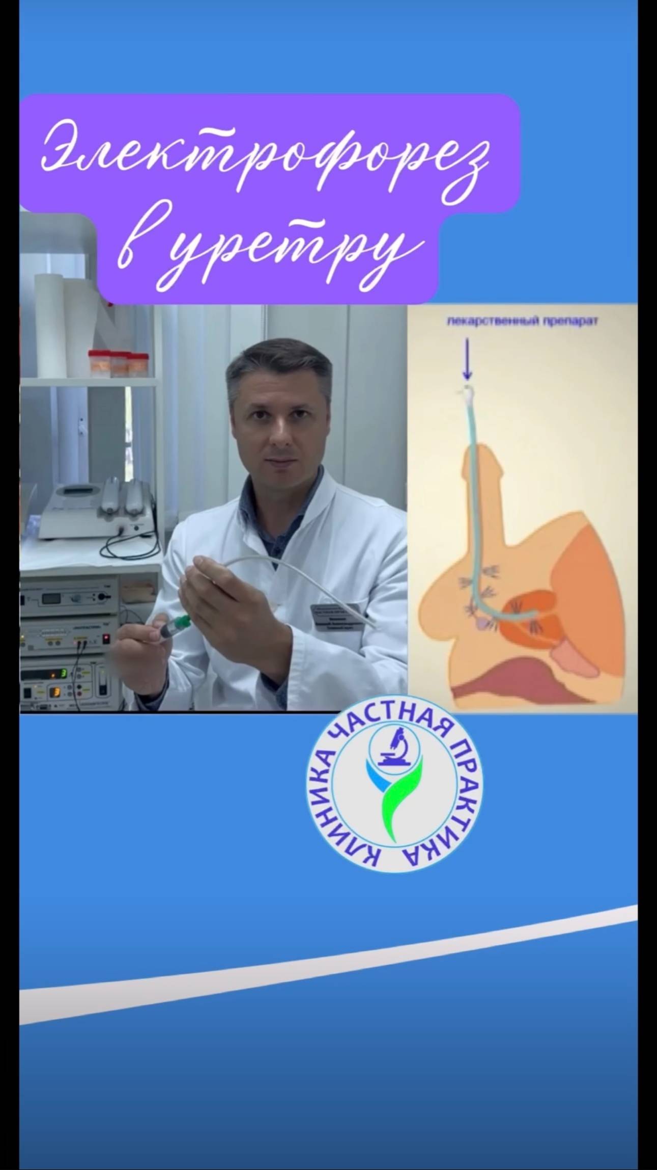 Электрофорез в уретру смотреть онлайн