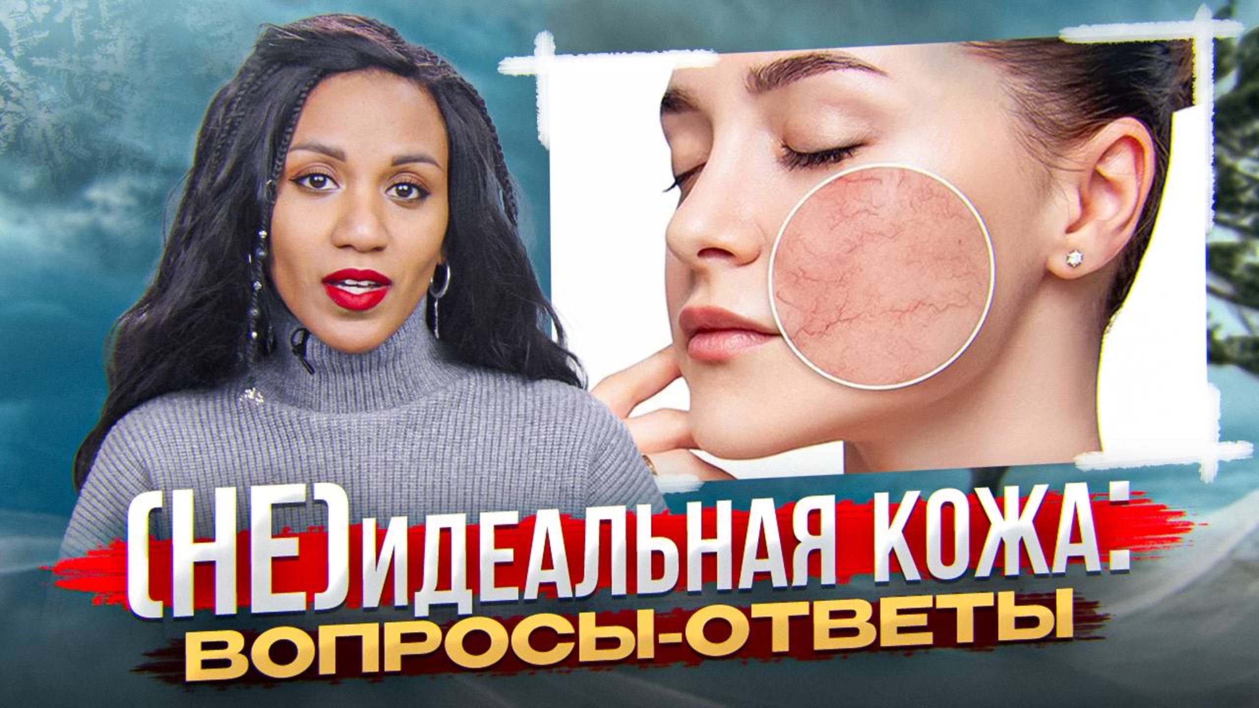 не(ИДЕАЛЬНАЯ) КОЖА: поры, купероз, чувствительность, жирность, сухость, пигментация // ВОПРОС-ОТВЕТ смотреть онлайн