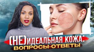 не(ИДЕАЛЬНАЯ) КОЖА: поры, купероз, чувствительность, жирность, сухость, пигментация // ВОПРОС-ОТВЕТ