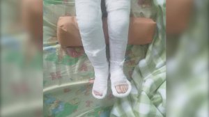 Трехлетний ребенок сломал ноги на новой спортплощадке в Бурятии