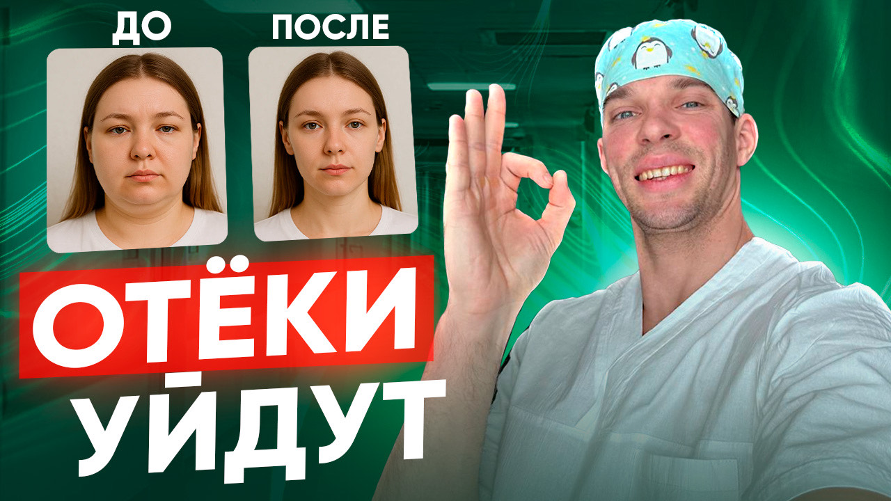 Как убрать ОТЁКИ во всём теле. смотреть онлайн