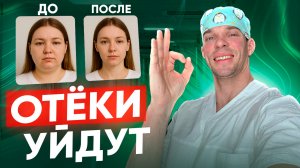 Как убрать ОТЁКИ во всём теле.