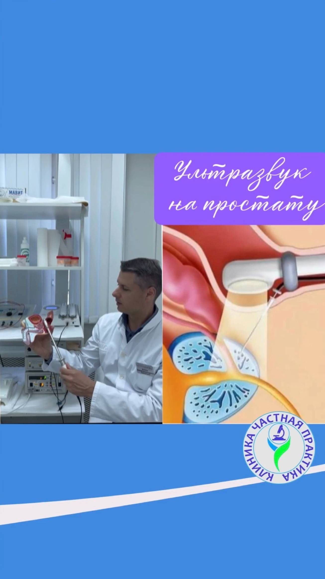 Ультразвук на простату смотреть онлайн