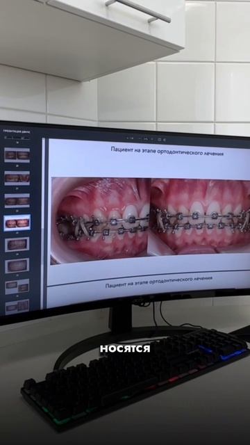 ЭЛАСТИКИ. Что это? смотреть онлайн