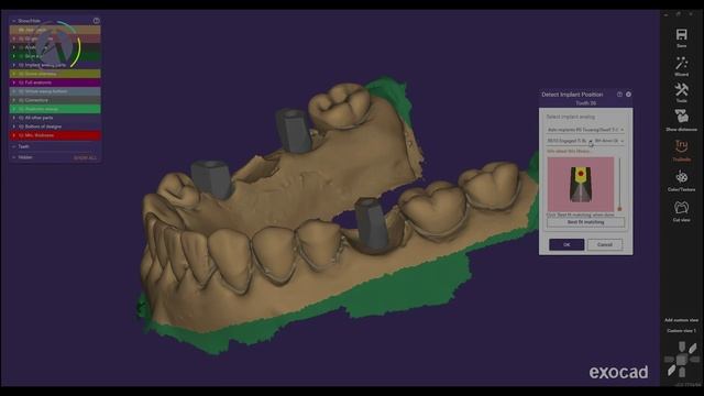 Руководство ADIN. Работа со ScanBody смотреть онлайн