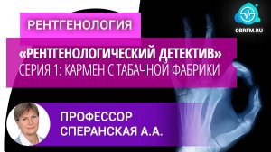 Профессор Сперанская А.А.: Цикл «Рентгенологический детектив». Серия 1: Кармен с табачной фабрики