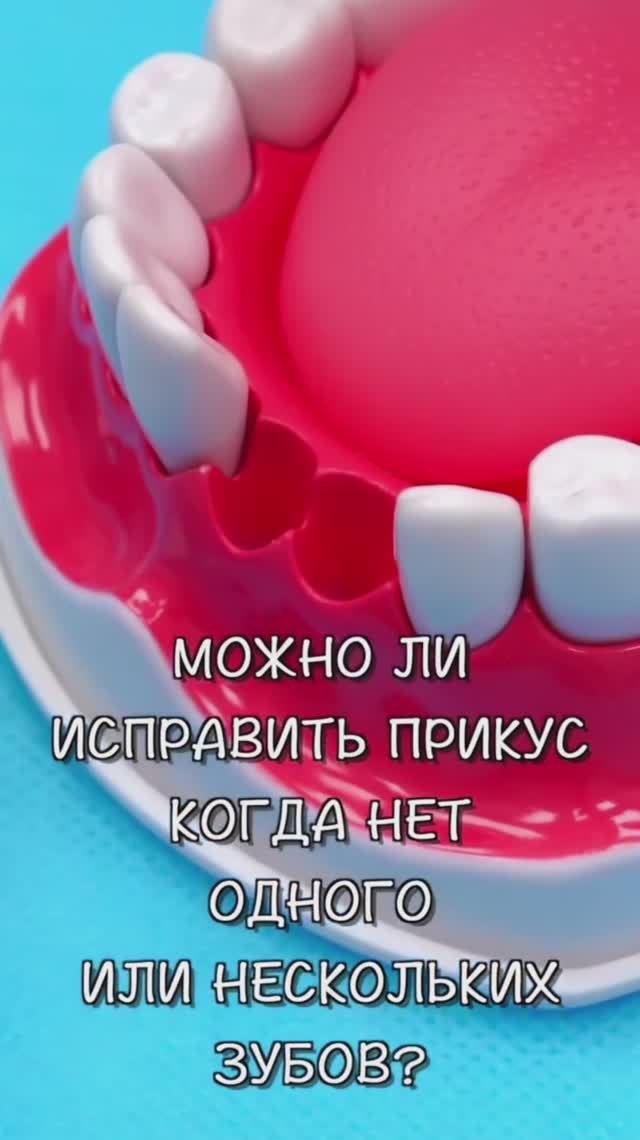 Исправление прикуса, если удалены зубы — ZemsClinic.ru