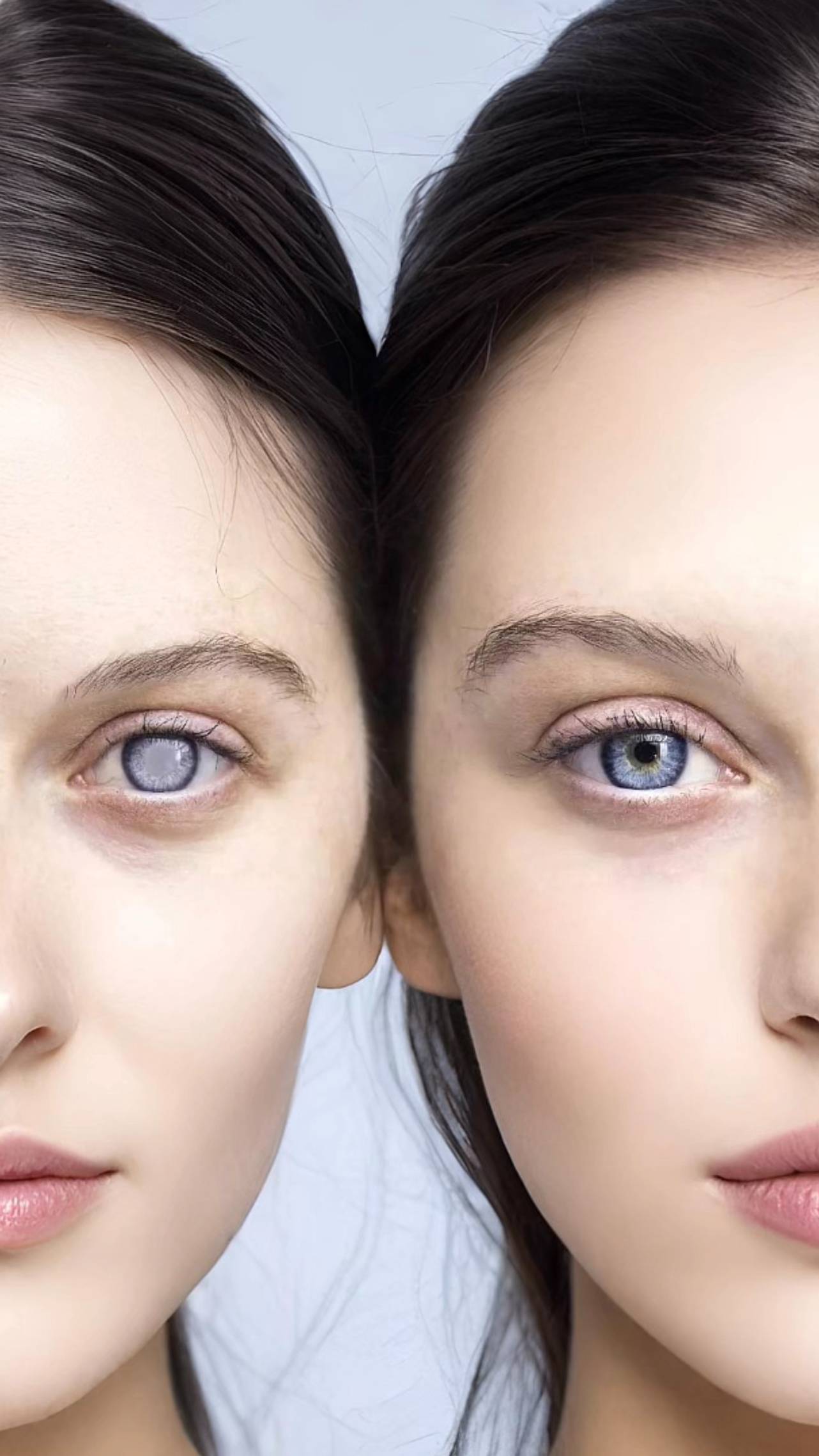 👁️ Катаракта — не просто возрастное изменение. смотреть онлайн