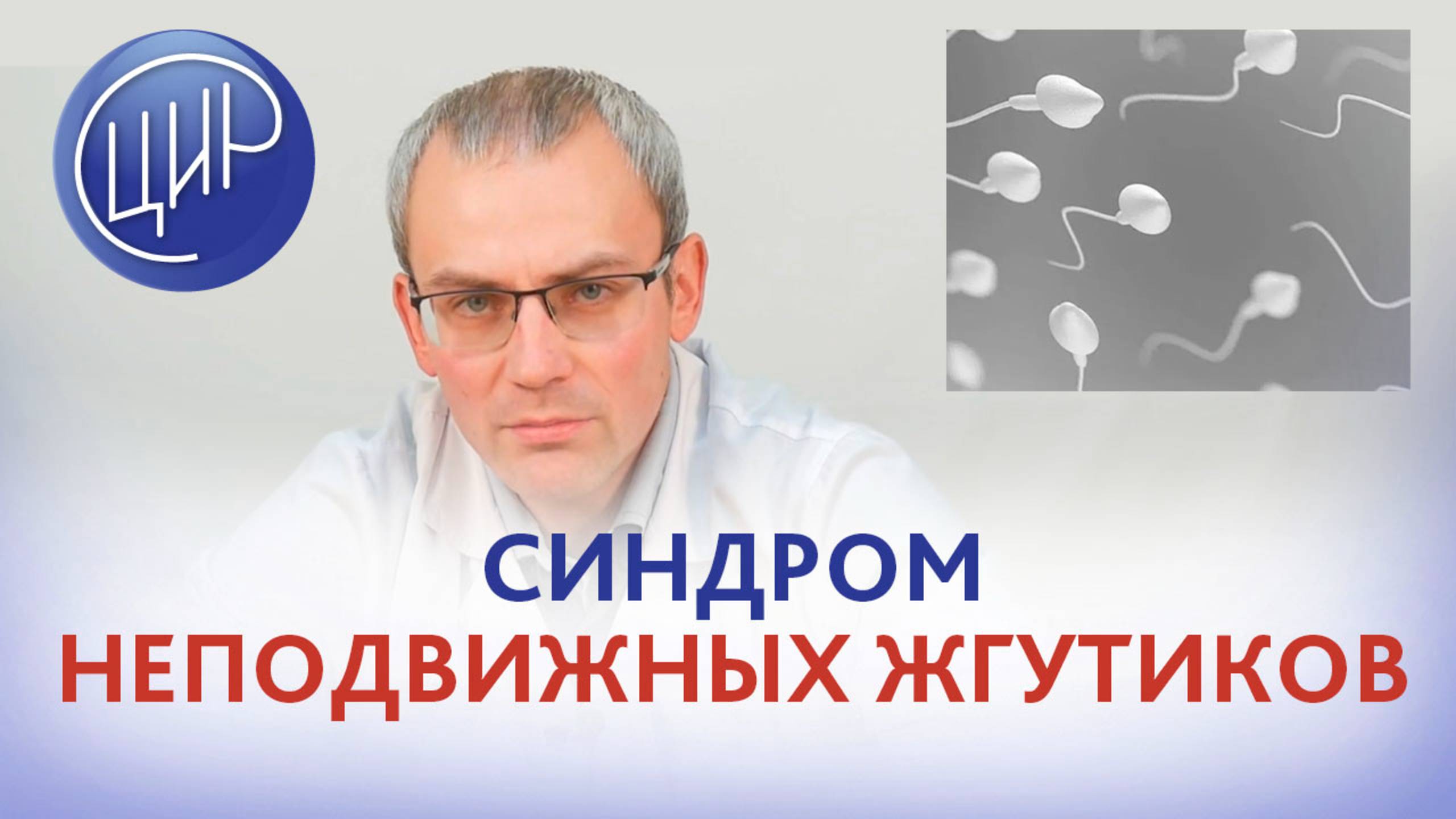 Синдром неподвижных жгутиков (первичная цилиарная дискинезия) - причина азооспермии и бесплодия. смотреть онлайн