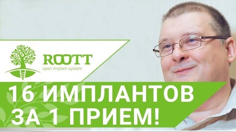 16 имплантов за 1 прием - Отзыв пациента об имплантации зубов в КЛИНИке ROOTT смотреть онлайн