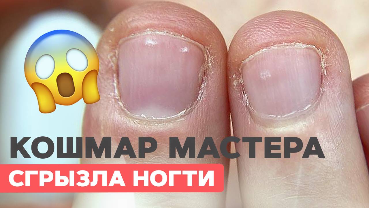 Что делать? Сложные ногти |Преображение обгрызенных ногтей смотреть онлайн