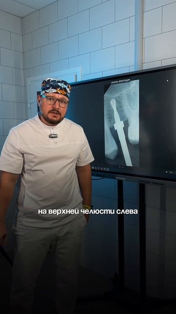 Синус-лифтинг! Что это и для чего он нужен?