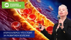 Вебинар Н.Г. Байкуловой "Атеросклероз. Что стоит за развитием болезни?"