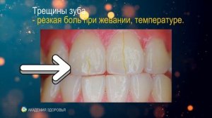 12 скрытых причин зубной боли!  То, о чём не говорят стоматологи
