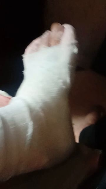 СЛОМАЛ НОГУ! РЫБАЛОВНЫЙ СЕЗОН ОСТАЛСЯ НЕ ЗАКРЫТЫМ!!!( ЭТО ПРОСТО ПОЛНЫЙ ПИ...Ц!!! БЕРЕГИТЕ СЕБЯ. смотреть онлайн