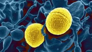 Стафилококки (Staphilococcus Aureus, Epidermidis, Saprophyticus) Патогенез, Диагностика, Лечение