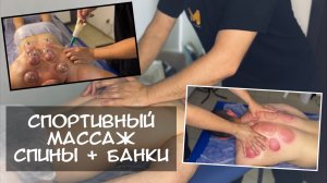 СПОРТИВНЫЙ СИЛОВОЙ МАССАЖ: ТРИГГЕРНЫЕ ТОЧКИ, ГИПЕРТОНУС МЫШЦ, ВАКУУМНЫЕ БАНКИ