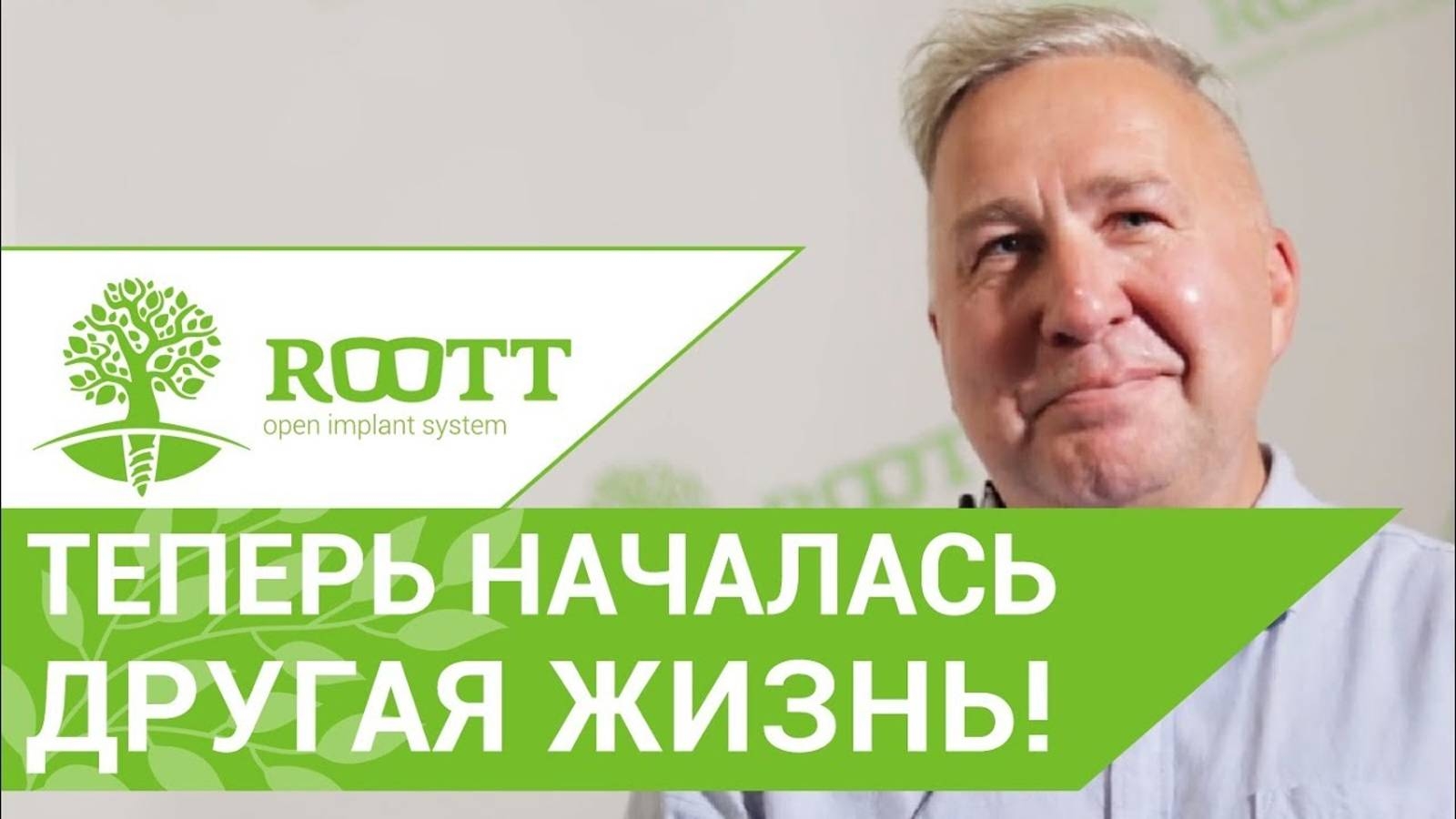 Базальная имплантация при полной адентии зубов. Видео отзыв пациента клиники ROOTT смотреть онлайн