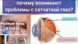 Причины разрыва и отслоения сетчатки глаз - в спазме 3-х глазных мышц. Упражнения