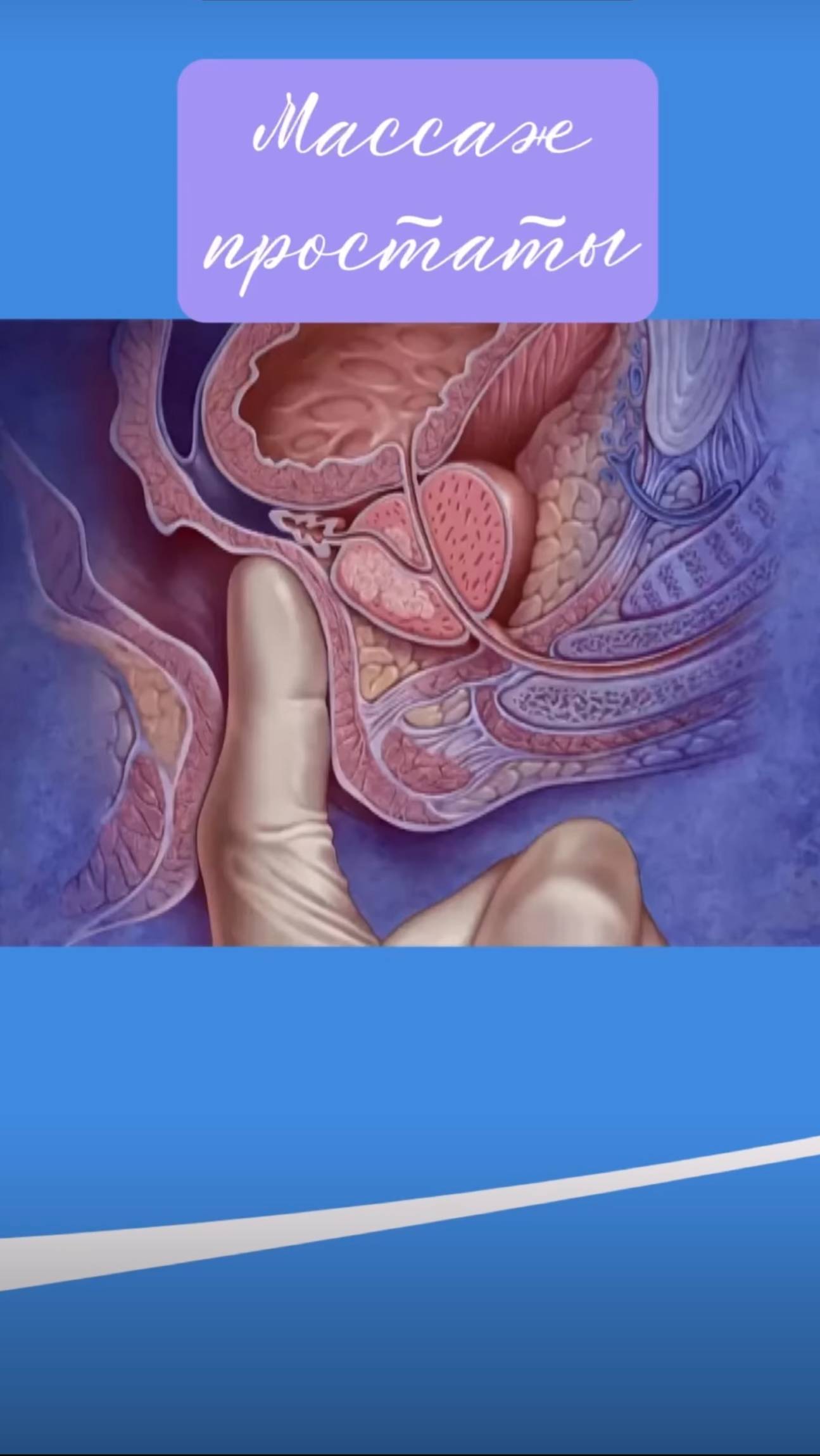 Массаж простаты смотреть онлайн