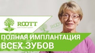 Преимущества одномоментной имплантации зубов - отзыв пациентки клиники ROOTT смотреть онлайн