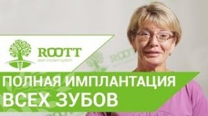 Преимущества одномоментной имплантации зубов - отзыв пациентки клиники ROOTT