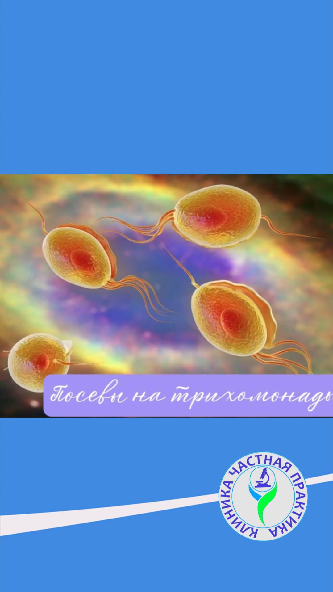 Посевы на трихомонады смотреть онлайн